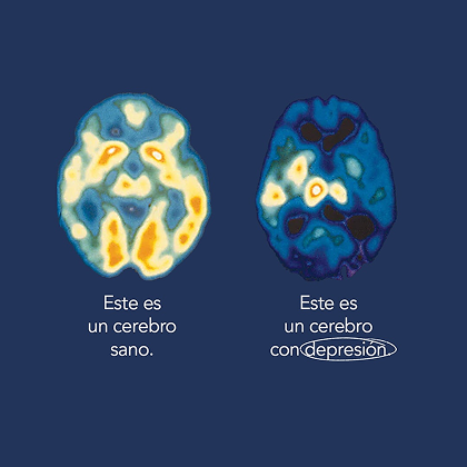 Post de Salud en Corto